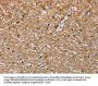 CEACAM6 Antibody