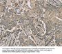 TFRC Antibody
