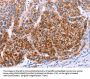 AADAC Antibody