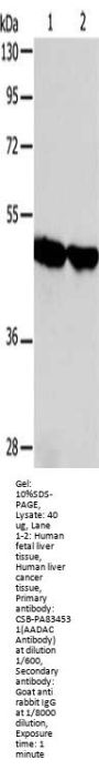 AADAC Antibody