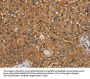 NT5C1A Antibody