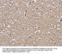 RAP1B Antibody
