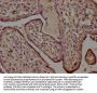 HTRA1 Antibody