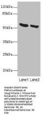 PNPLA2 Antibody