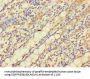 PNPLA2 Antibody