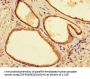 YIPF6 Antibody