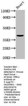 PRR11 Antibody