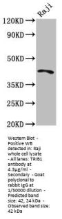 TRIB1 Antibody