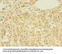 DHRSX Antibody