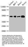 CBLL2 Antibody