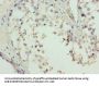 L3MBTL4 Antibody