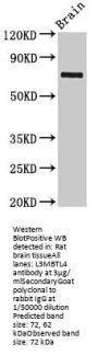 L3MBTL4 Antibody