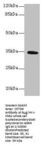 SETD9 Antibody