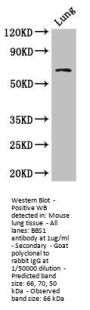 BBS1 Antibody