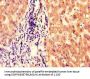 BBS1 Antibody