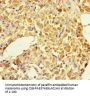 BLOC1S5 Antibody
