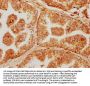 FAR1 Antibody