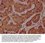 SSH1 Antibody