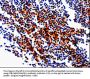 GDI1 Antibody