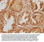 EDEM1 Antibody