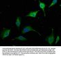 AIDA Antibody