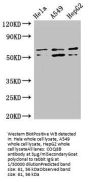 COQ8B Antibody