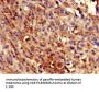 COQ8B Antibody
