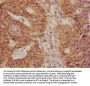 ZBED3 Antibody
