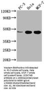 CCDC74B Antibody