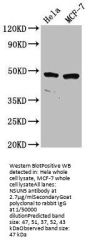 NSUN5 Antibody
