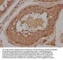 ADCY10 Antibody