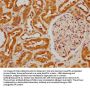 FIZ1 Antibody