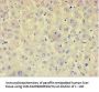 AFAP1 Antibody