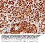 CHST14 Antibody