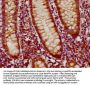 GLIS3 Antibody