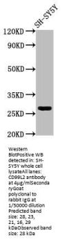 CD99L2 Antibody
