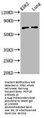 POF1B Antibody