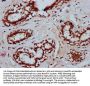 TSEN15 Antibody