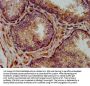 NLRP7 Antibody