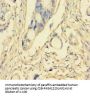 PIK3R5 Antibody
