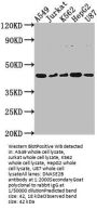 DNASE2B Antibody