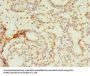 SMPDL3A Antibody