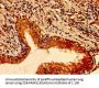 TFAP2C Antibody