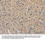 ALDH8A1 Antibody
