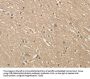 ALDH8A1 Antibody