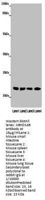 ABHD14B Antibody