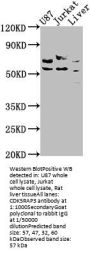CDK5RAP3 Antibody