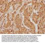 WFIKKN1 Antibody