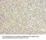 CATSPER2 Antibody