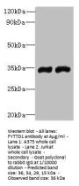 FYTTD1 Antibody
